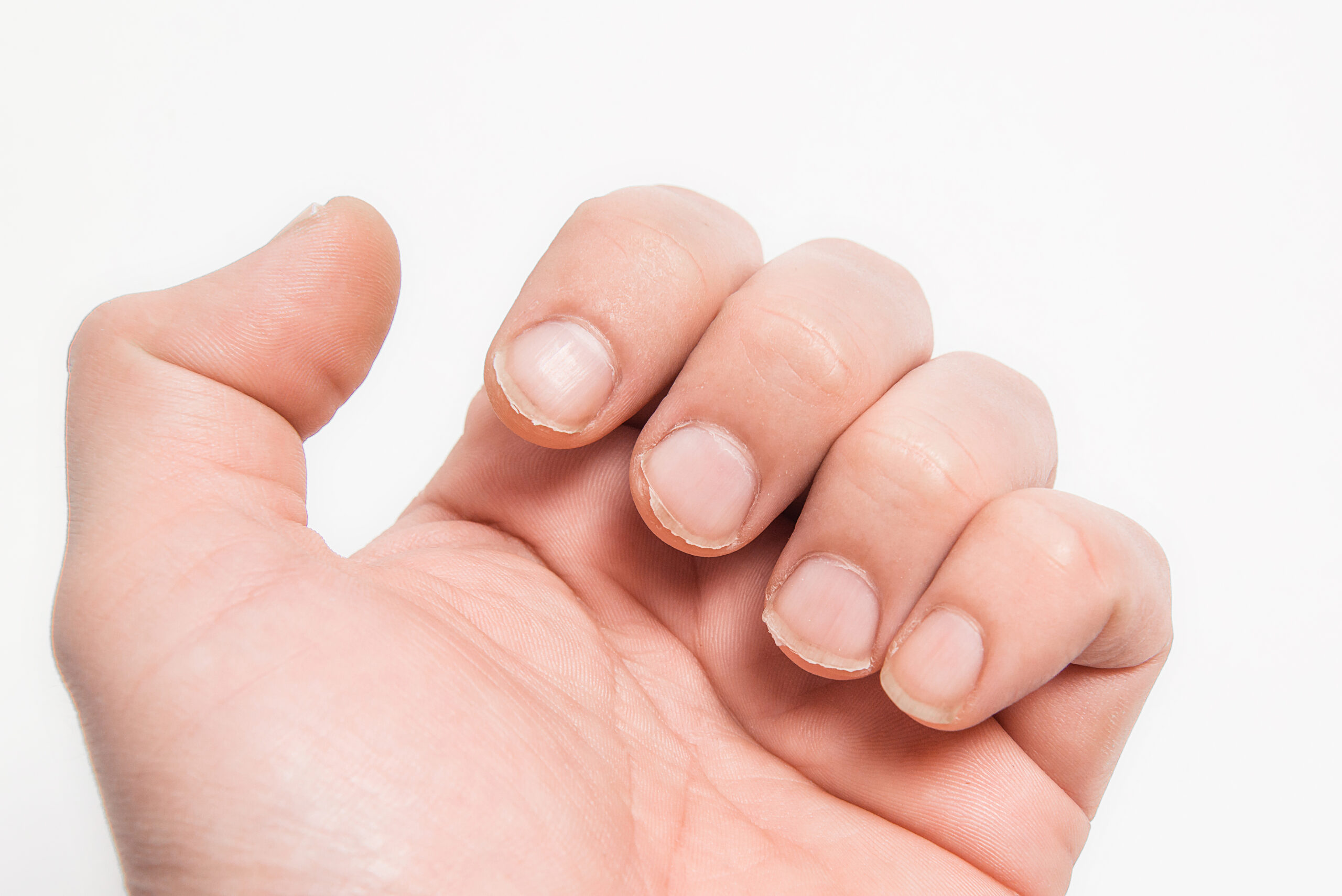 closeup of bitten nails